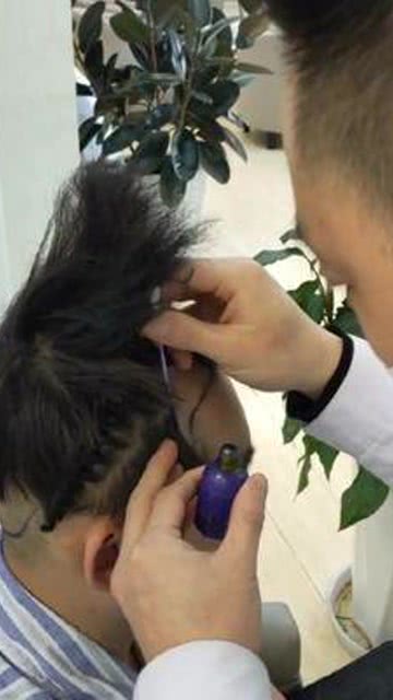头发种植技术：入门难易度揭秘，你准备好了吗？