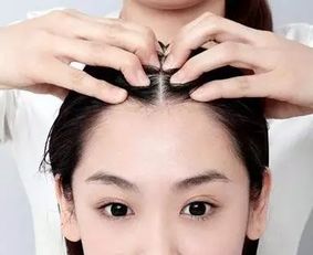 揭秘毛发种植技术：如何重拾自信，焕发自然风采？